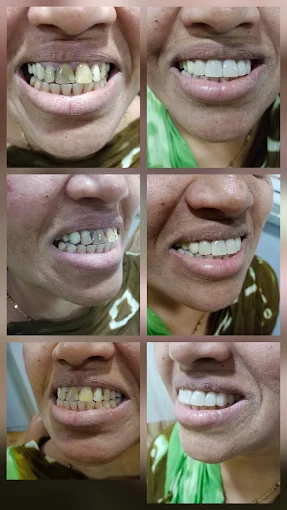 Pooja Smile Care Dental Gallery Image 10